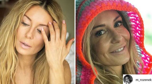 Co się stało z ustami Małgorzaty Rozenek? Internautki zauważyły coś niepokojącego