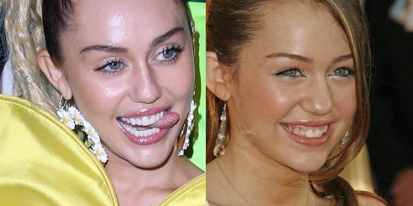 Jak zęby zmieniły twarze gwiazd