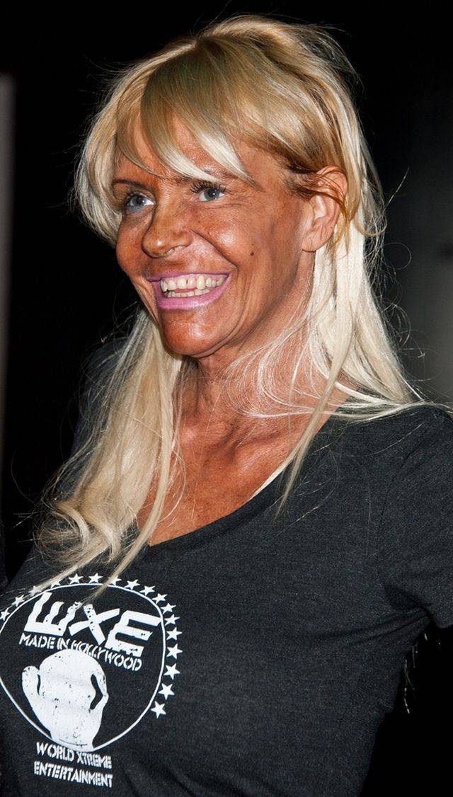 Gwiazdy, które przesadziły z opalaniem