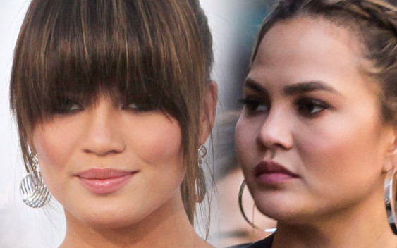 Szokujące wyznanie Chrissy Teigen o jej operacjach plastycznych