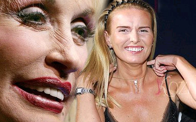 Dużo zdjęć i porcja metamorfoz