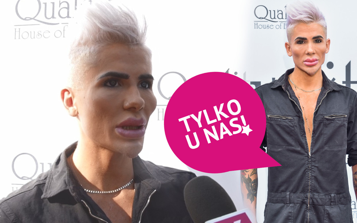 Polski “Żywy Ken” o implantach klatki piersiowej: “Po wybudzeniu z narkozy jest dramat”