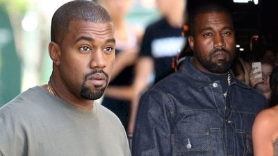 Kanye West lansuje nową fryzurę czy cierpi na pewną chorobę?