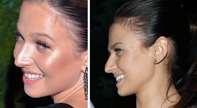 Czy Anna Lewandowska zrobiła nosek?