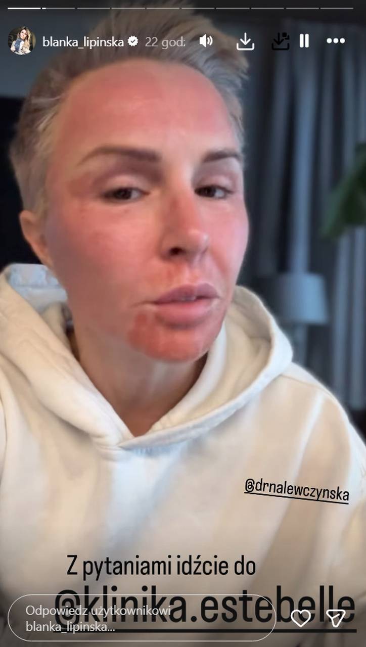 Blanka Lipińska, fot. Instagram