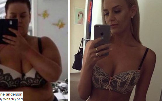 Schudła ponad 90 KILOGRAMÓW i nie uwierzycie, co stało się z jej CIAŁEM