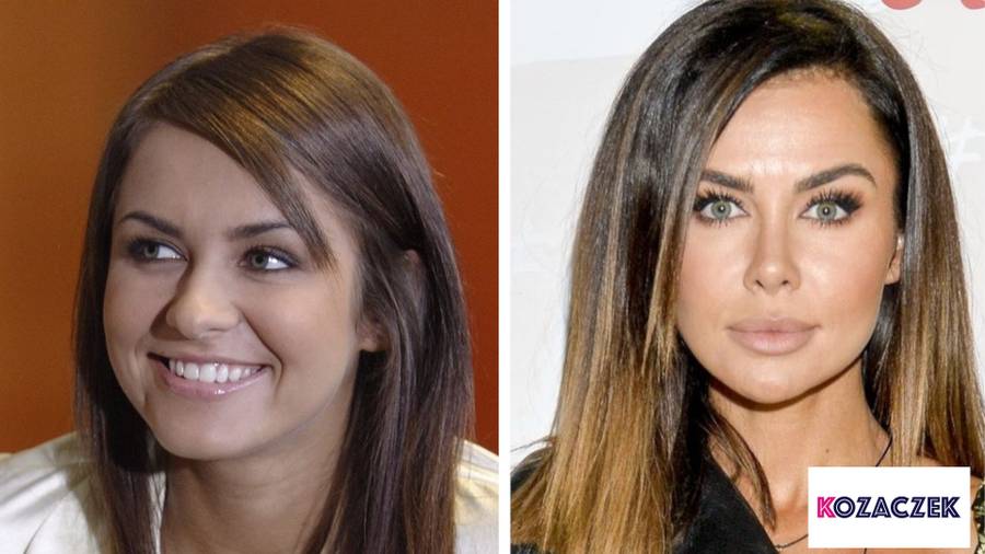 Które polskie gwiazdy powiększały usta? Porównujemy zdjęcia – STARE i NOWE