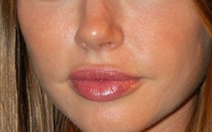 Sophie Monk żałuje operacji plastycznych