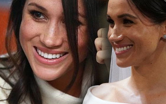 Ten urodowy detal Meghan Markle robi FURORĘ. Jeśli to masz, jesteś szczęściarą