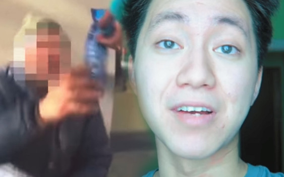 Szok! Nakarmił bezdomnego pastą do zębów. Pójdzie do więzienia!