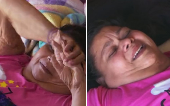 SZOK! Zerwała szwy po operacji wycinania nadmiaru skóry, bo uprawiała seks