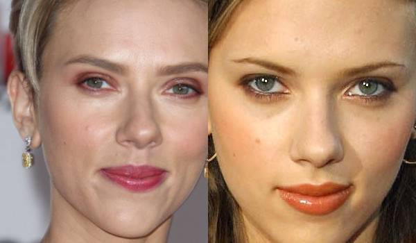 Jak operacja nosa zmieniała twarze gwiazd