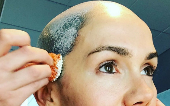 Aktorka chwali się łysiną na Instagramie! Kto to taki?