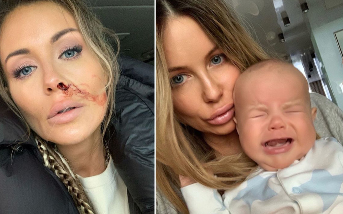 Małgorzata Rozenek wrzuciła zakrwawione zdjecie. Fanka atakuje