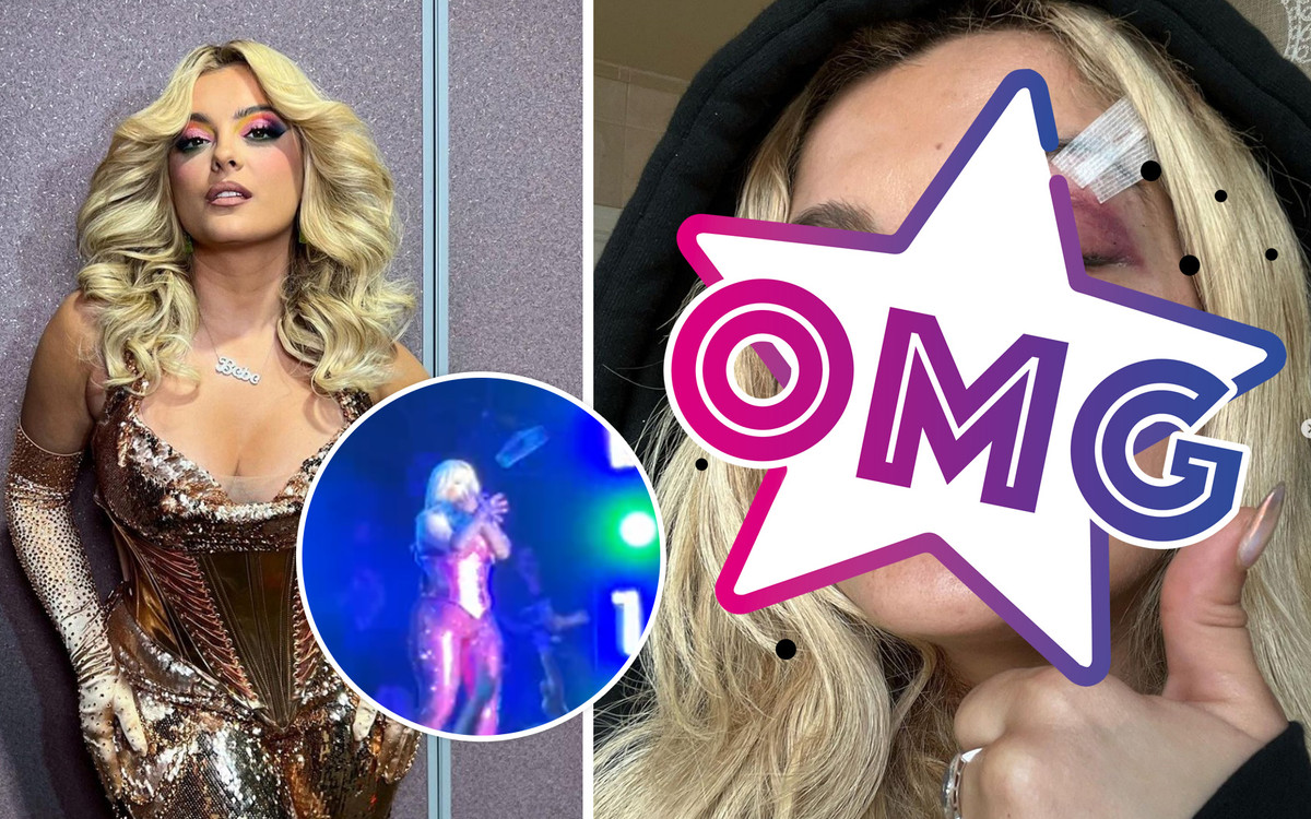 Bebe Rexha dostała telefonem w twarz podczas koncertu. Pokazała ogromne limo (WIDEO I ZDJĘCIA)