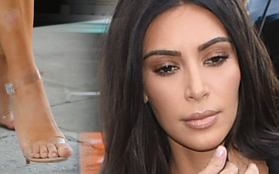 Absurd? Nogi Kim Kardashian już nigdy nie będą tak wyglądać