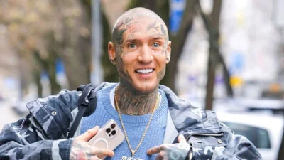 Stifler pokazał doczepione włosy. Fani zszokowani metamorfozą