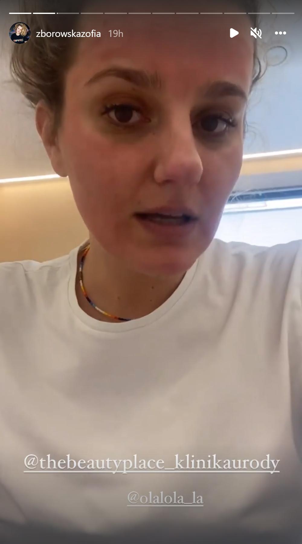 Zofia Zborowska zrobiła zabieg na twarz i ŻAŁUJE