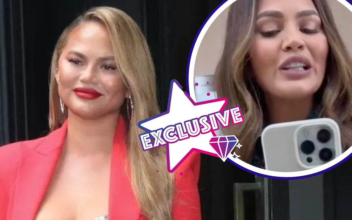 Chrissy Teigen PRZESADZIŁA z wypełniaczami? Lekarka mówi o efekcie “pillow face”!