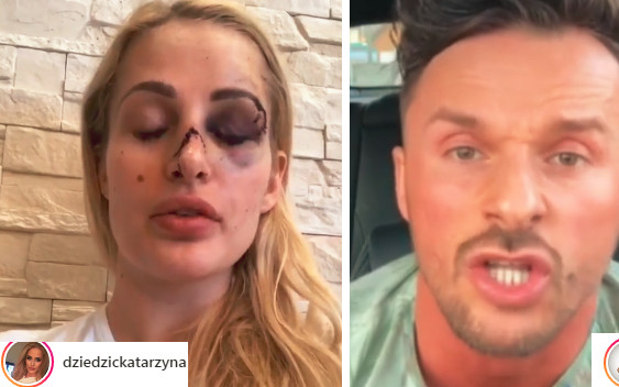 Qczaj o trenerze, który ZMASAKROWAŁ twarz dziewczynie: Nieważne, czy zasłużyła!