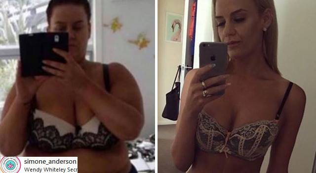 Schudła ponad 90 KILOGRAMÓW i nie uwierzycie, co stało się z jej CIAŁEM