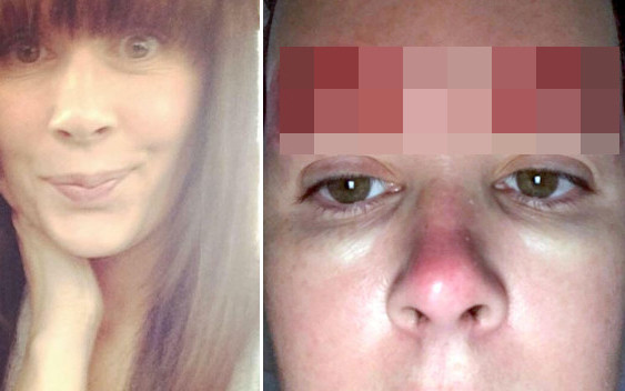 Jej marzeniem były piękne brwi, a z salonu wyszła Z TYM