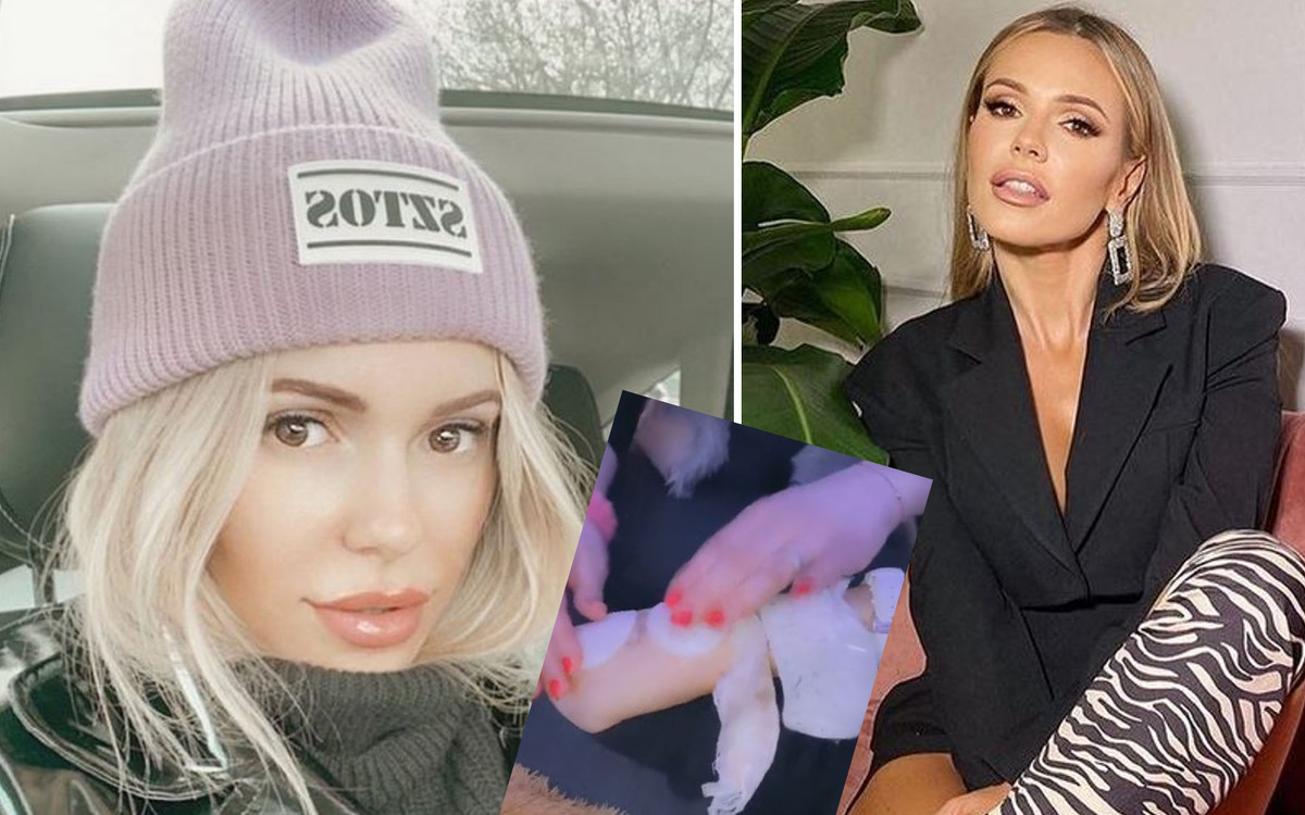 Doda relacjonuje usuwanie tatuażu: “Przemyślcie te swoje ku**a tatuaże, to jest taki BÓL”