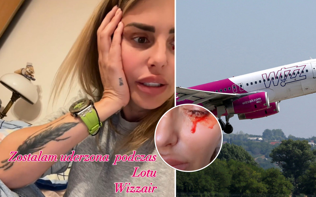 Monika Goździalska pobita w samolocie przez współpasażera! “Mam coś uszkodzone wewnątrz” (FOTO)