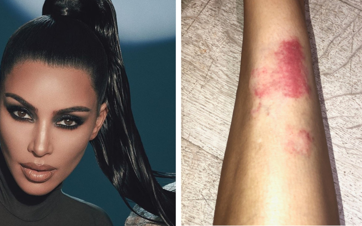 Kim Kardashian po raz pierwszy tak SZCZERZE o chorobie: “Nie mogłam nawet odebrać telefonu”