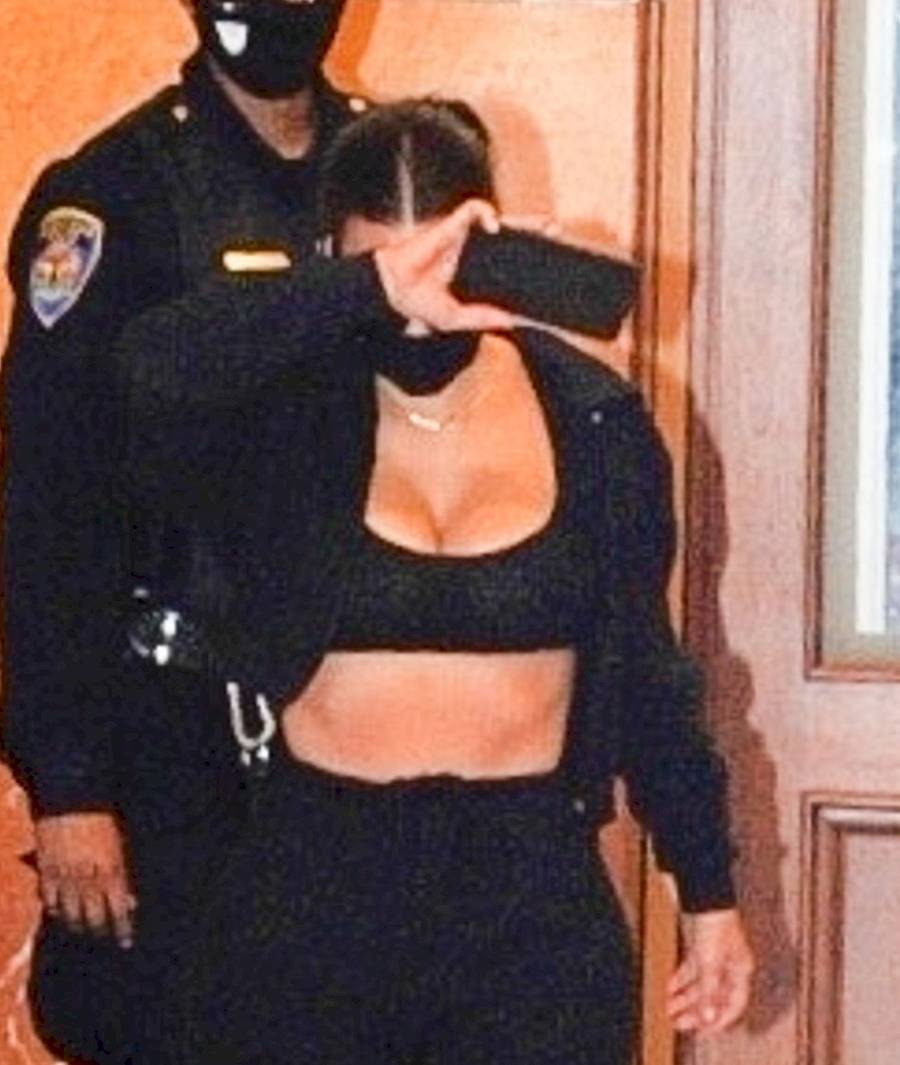 Kim Kardashian znów ma problemy z łuszczycą?