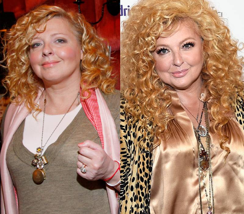 10 years challenge – tak gwiazdy wyglądały 10 lat temu!