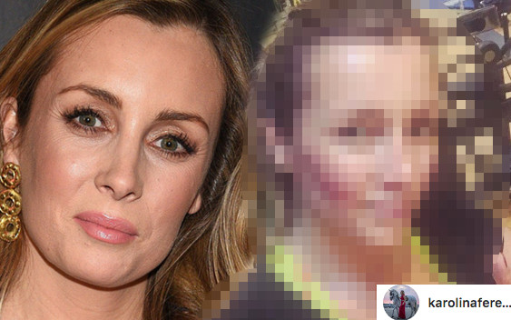 Karolina Ferenstein-Kraśko BARDZO schudła! (ZDJĘCIE)