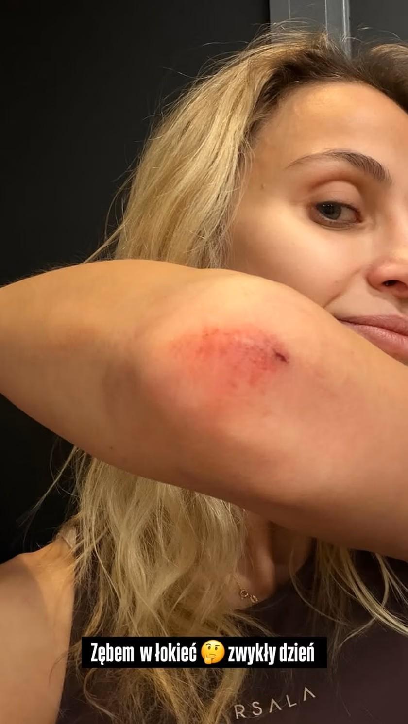 Hania Żudziewicz, fot. Instagram