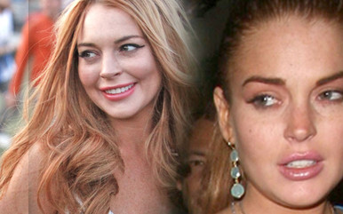 Nałogi odebrały Lindsay Lohan urodę (FOTO)