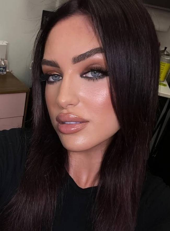 Metamorfoza Caroline Derpieński, fot. Instagram