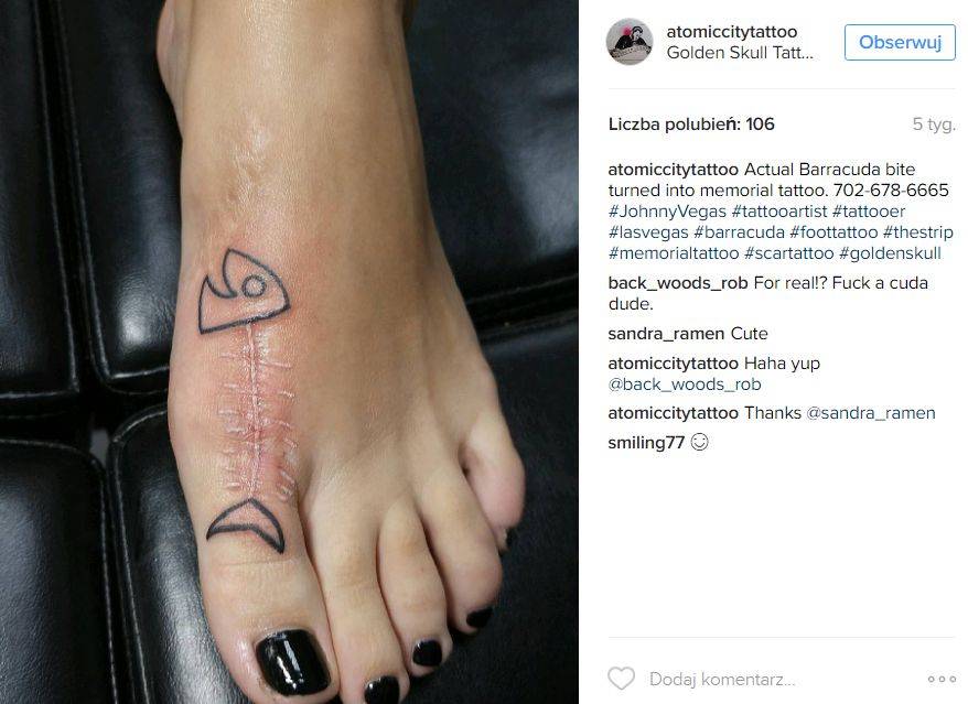 Tatuaże, które kamuflują blizny