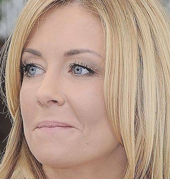 10 zaskakujących zbliżeń na twarz Małgorzaty Rozenek