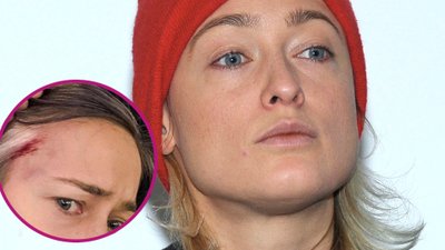 SZOK!Matylda Damięcka POBITA na marszu! Pokazała obrażenia