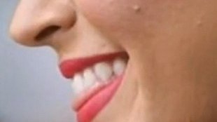 Katy Perry: specyfiki przeciw trądzikowi nie działają