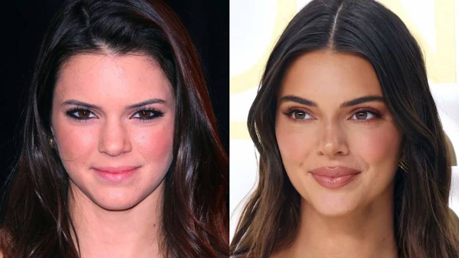 Kendall Jenner/ Instagram