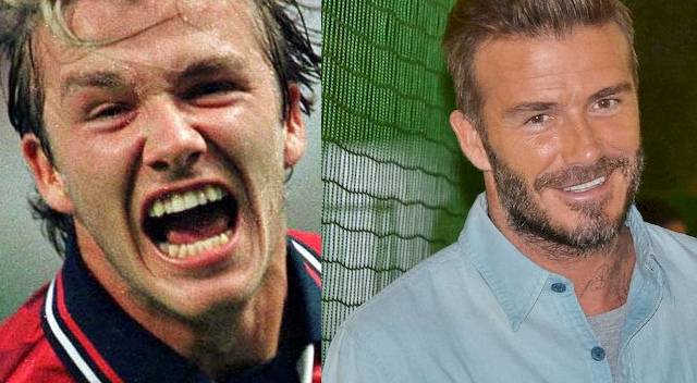 TE gwiazdy miały TRAGICZNE zęby!