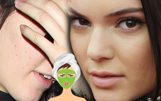 Wystarczyła maseczka z tych dwóch składników, by Kendall Jenner pozbyła się trądziku!