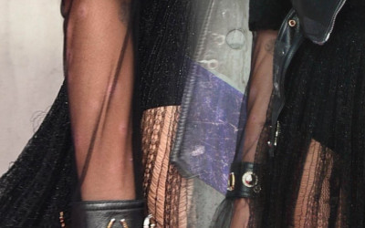 Mogła przykryć plamy po łuszczycy podkładem? Ona nie wstydzi się swojej choroby