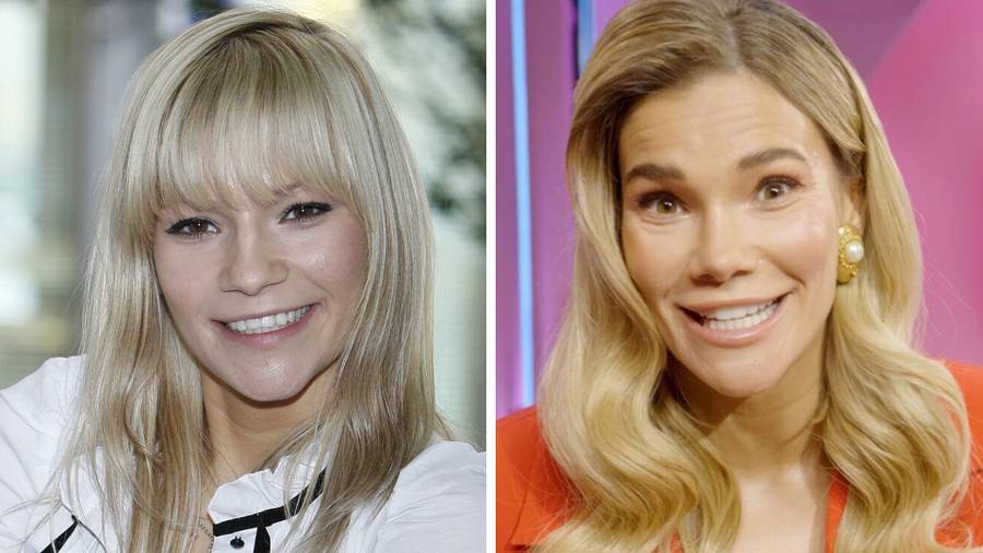 Te gwiazdy zrobiły sobie nowe zęby: Lewandowska, Halejcio, Pazura, Rozenek, Ibisz, Kubicka, Lil Masti… (FOTO)