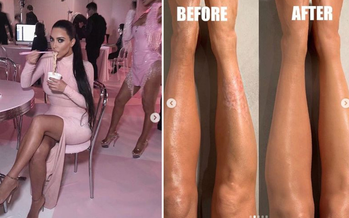 Kim Kardashian pokazała, jak maskuje łuszczycę