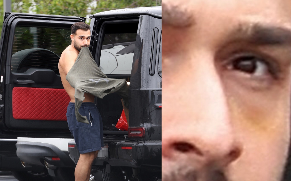 Sam Ashagari oskarża Britney Spears o pobicie!