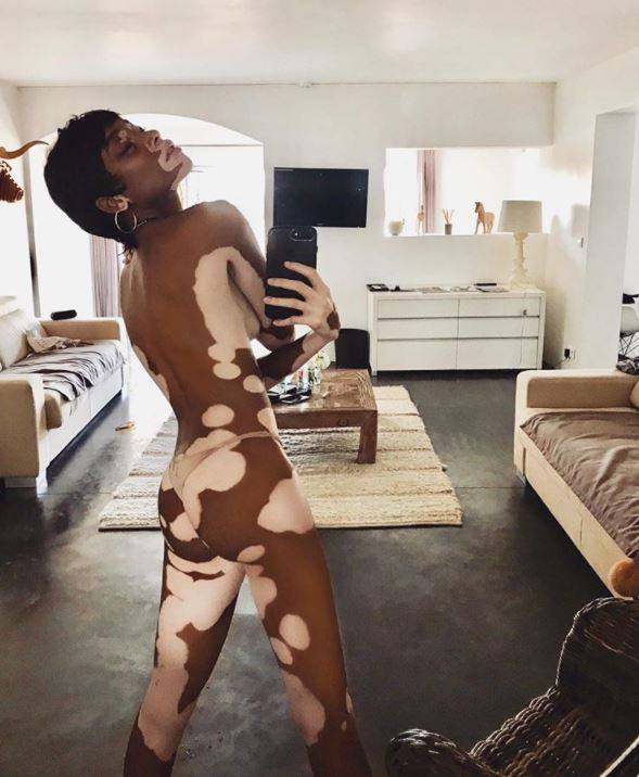 Winnie Harlow: Dzieci nazywały mnie krową