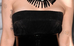 Zamieściła na Twitterze takie obrzydliwe zdjęcie (FOTO)