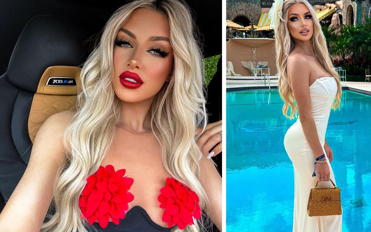 Fanka krytykuje garb na nosie Caroline Derpieński. Celebrytka nie powstrzymała się!