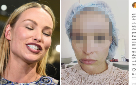 O Boziu! O matko! Przerażające! Fani komentują selfie Weroniki Książkiewicz